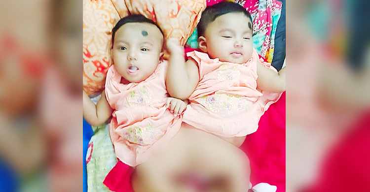 জোড়া লাগা নুহা-নুবার চিকিৎসার দায়িত্ব নিলেন প্রধানমন্ত্রী