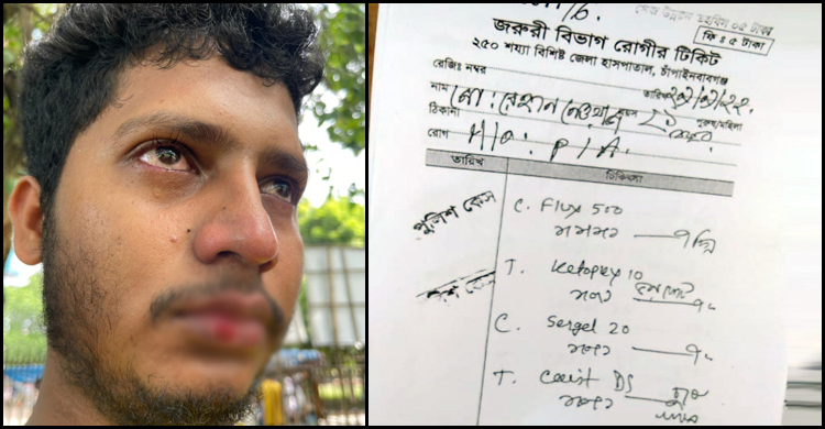 পরীক্ষা দিয়ে ফেরার পথে কলেজছাত্রকে পেটালেন ছাত্রলীগ নেতা