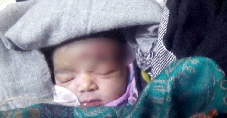 সিজার করলেন আয়া-নার্স, নবজাতকের কপালে ৯ সেলাই