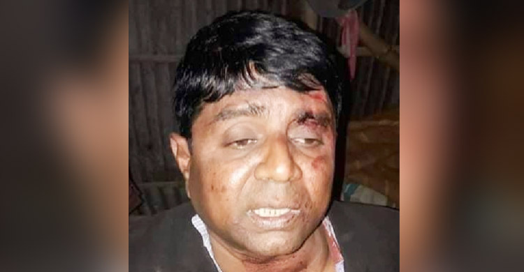 নারীর সঙ্গে ‘আপত্তিকর’ অবস্থায় আটকের পর আ.লীগ নেতাকে পিটুনি