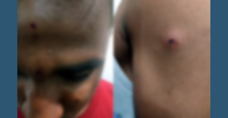 নির্বাচনী উঠান বৈঠকে গুলি, আহত ৫