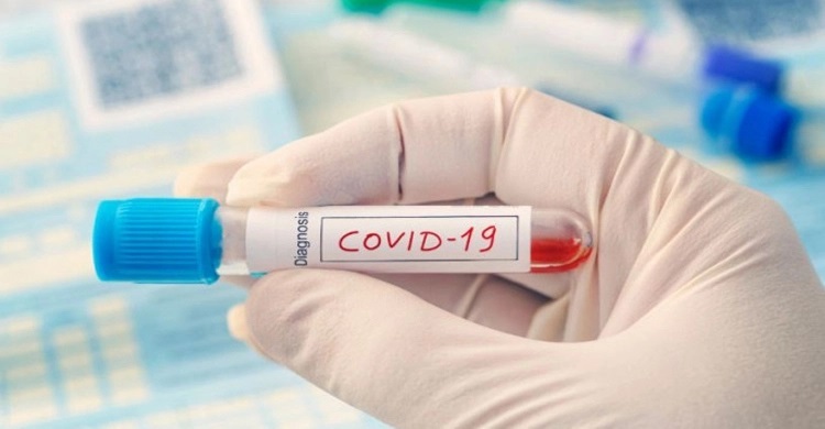 Two cases of Indian Covid-19 variant found in Jashore
