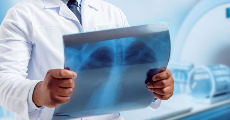 Covid-19: Lung damage ‘identified’ in study