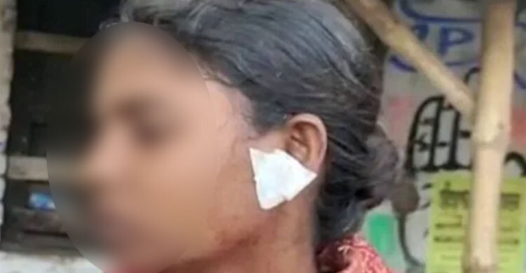 পশ্চিমবঙ্গে পরকীয়ার জেরে নারীর কান কেটে দিলেন তরুণী!