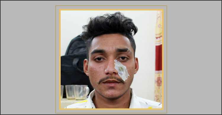 ঘুষি মেরে শিক্ষার্থীর নাক ফাটালেন অফিস সহকারী