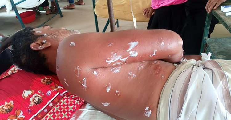 চাক ভাঙতে গিয়ে ভীমরুলের কামড়ে ব্যবসায়ীর মৃত্যু