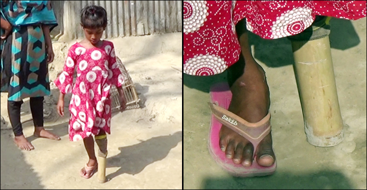 এখনো বাঁশে ভর করে হাঁটছে হাবিবা