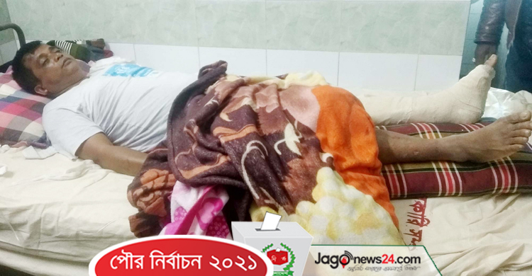 গভীর রাতে কাউন্সিলর প্রার্থীর হাত-পা ভেঙে দিল দুর্বৃত্তরা