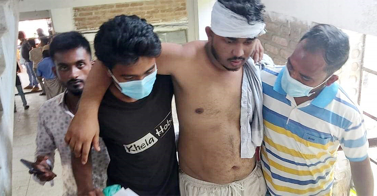 অর্ডার নিতে দেরি হবে বলায় দোকানিকে কুপিয়ে জখম