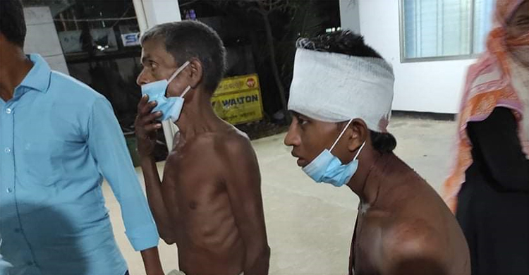 জমি নিয়ে বিরোধে ঢাবি শিক্ষার্থীকে কুপিয়ে জখম