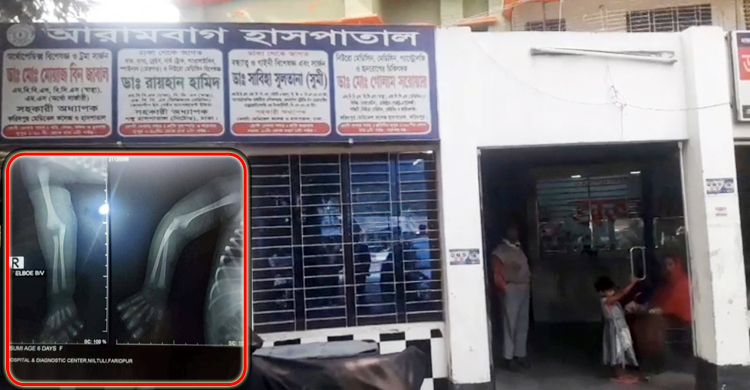সিজারের সময় নবজাতকের হাত ভাঙার অভিযোগ, বন্ধ হাসপাতাল