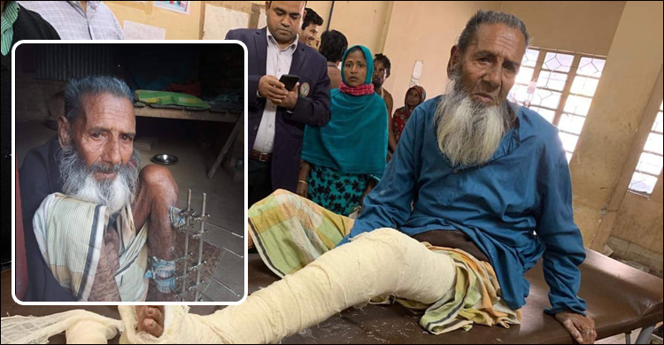 ফেসবুকের কল্যাণে পায়ের রড খোলা হলো ৮০ বছরের বৃদ্ধের
