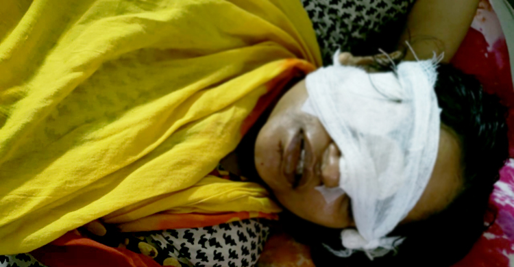 শ্রেণিকক্ষের ফ্যানের আঘাতে চোখ হারালেন শিক্ষিকা