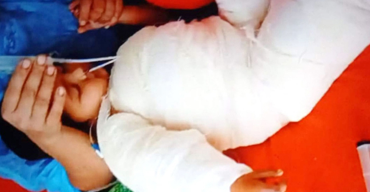 ফরিদপুরে আগুন পোহাতে গিয়ে শিশু দগ্ধ, ৬ দিন পর মৃত্যু