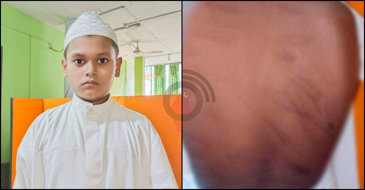 পড়া না পারায় ছাত্রকে বেদম পেটালেন শিক্ষক