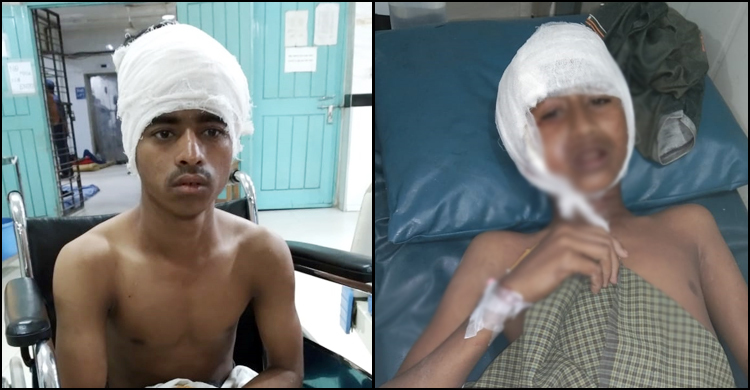 রোহিঙ্গা দুষ্কৃতকারীদের গুলিতে দুই কিশোর গুলিবিদ্ধ