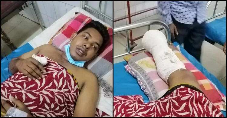 সীতাকুণ্ডে বিস্ফোরণে পা হারানো পুলিশ সদস্যের অস্ত্রোপচার
