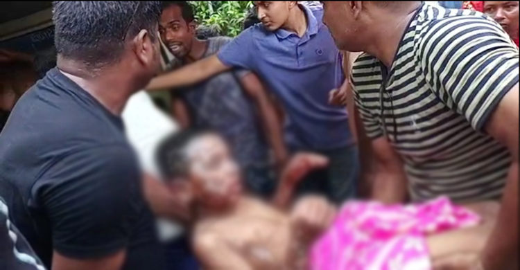 রাজবাড়ীতে সিলিন্ডারের আগুনে শিশুসহ দগ্ধ ৪
