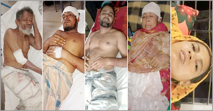 কার্ডে নামের সঙ্গে আলহাজ না লেখায় হামলা, আহত ৫