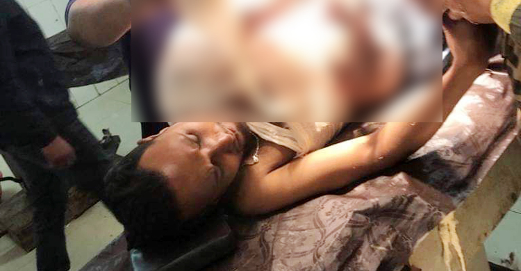 ফরিদপুরে স্বেচ্ছাসেবক লীগ নেতাকে কুপিয়ে জখম