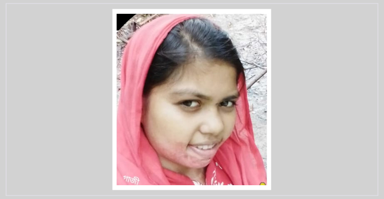 অ্যাসিডদগ্ধ মেয়েকে ভারতে ফেলে চলে এলেন বাবা-মা