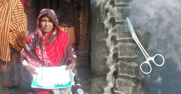 অপারেশনের ১৯ বছর পর রোগীর পেটে মিললো কাঁচি