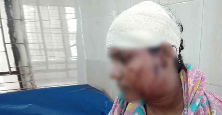 স্ত্রীকে ক্রিকেট ব্যাট দিয়ে পিটিয়ে রক্তাক্ত করলেন স্বামী