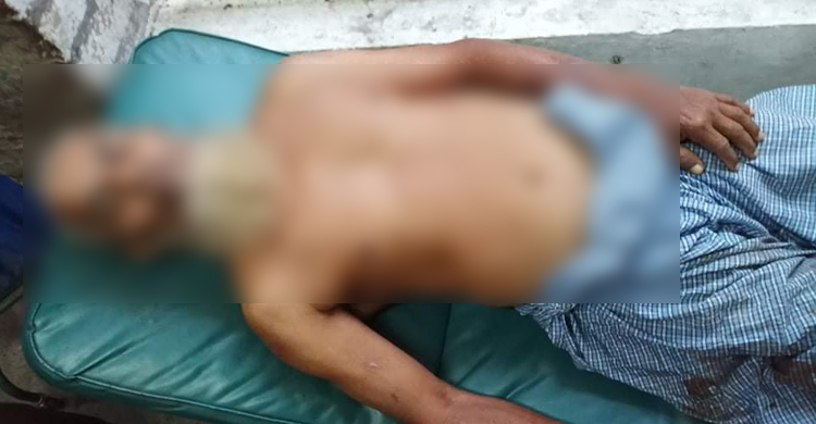 হত্যা মামলার বাদীকে পেটালেন আসামিরা