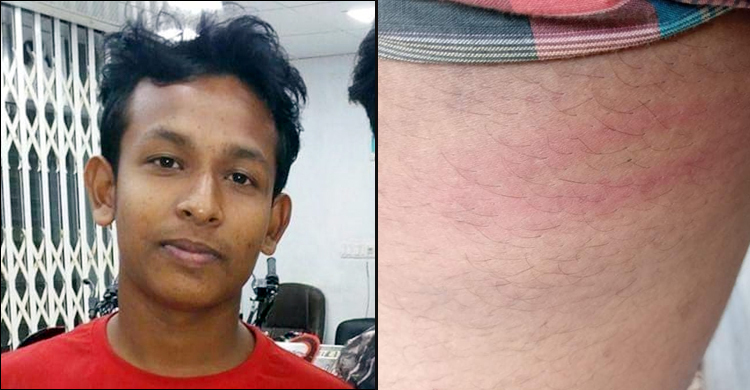 কুষ্টিয়ায় পুলিশ হেফাজতে সাংবাদিক নির্যাতনের অভিযোগ