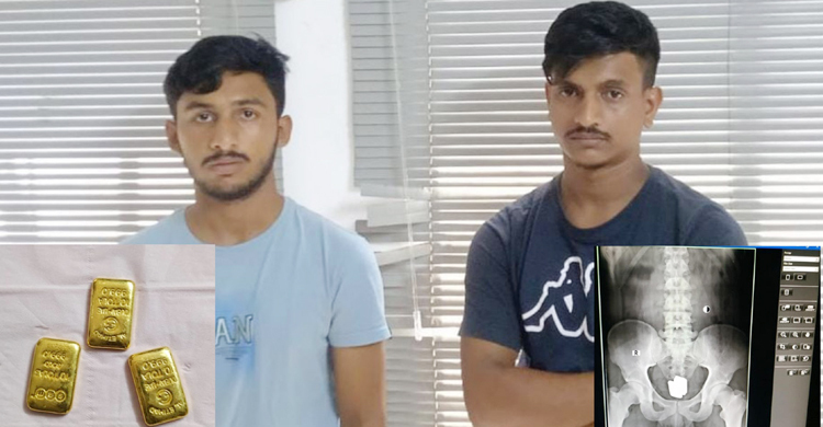 পায়ুপথ থেকে বের করা হলো ৩৫০ গ্রাম স্বর্ণের বার