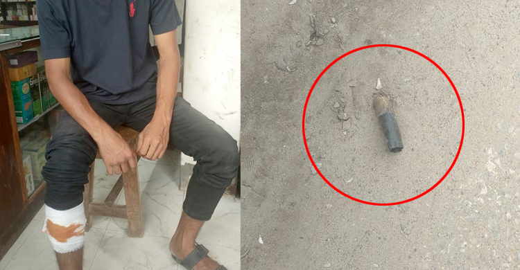 কোম্পানীগঞ্জে আবার গুলি, পালাতে গিয়ে আহত ৫