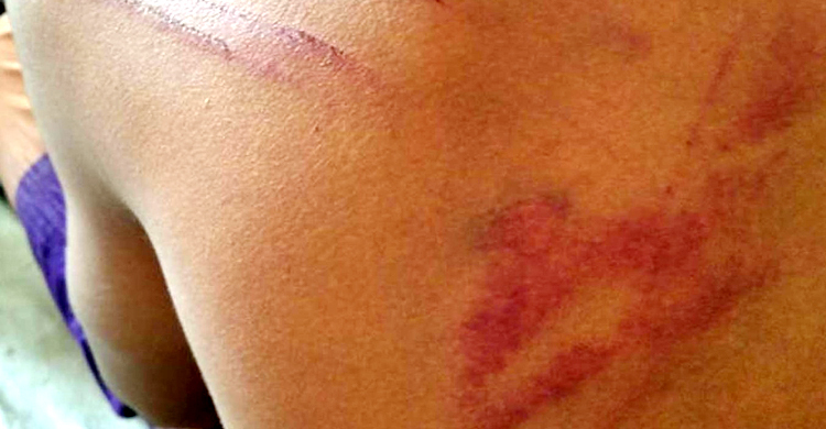 বরগুনায় কিশোর গ্যাংয়ের হামলায় ছাত্রলীগ নেতাসহ আহত ৫