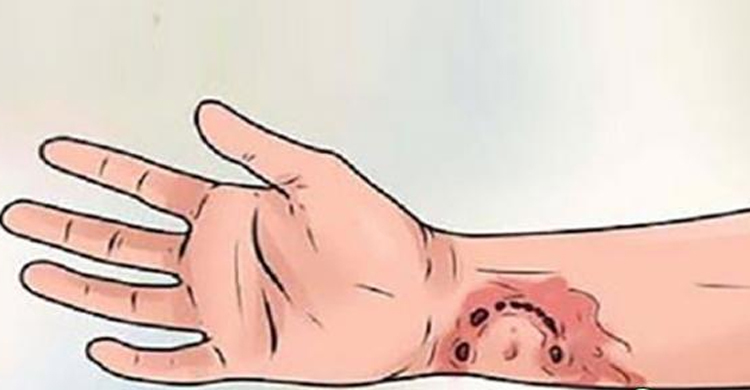 পুলিশের হাতে কামড় দিলেন মাদকসেবী