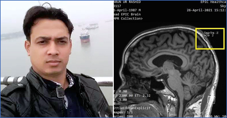 ‘মস্তিষ্ক হ্যাকের’ অভিযোগ কক্সবাজারের হারুনের, আসলে কি সম্ভব?