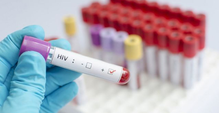 এবার এইচআইভি মুক্ত হলেন মার্কিন নারী