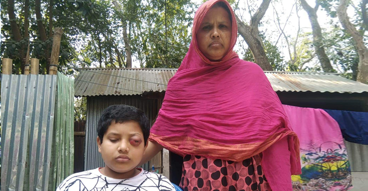 টাকা নেই তাই চিকিৎসাও নেই ব্লাড ক্যান্সারে আক্রান্ত জাভেদের