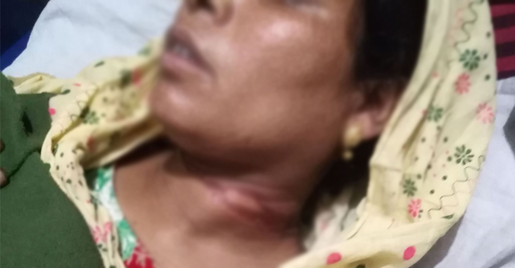 ছোট ভাইয়ের স্ত্রীকে গলাটিপে হত্যাচেষ্টার অভিযোগ ভাসুরের বিরুদ্ধে