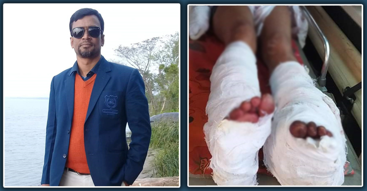 বিয়ের অনুষ্ঠানে যাওয়ার পথে ইউপি চেয়ারম্যানকে কুপিয়ে জখম