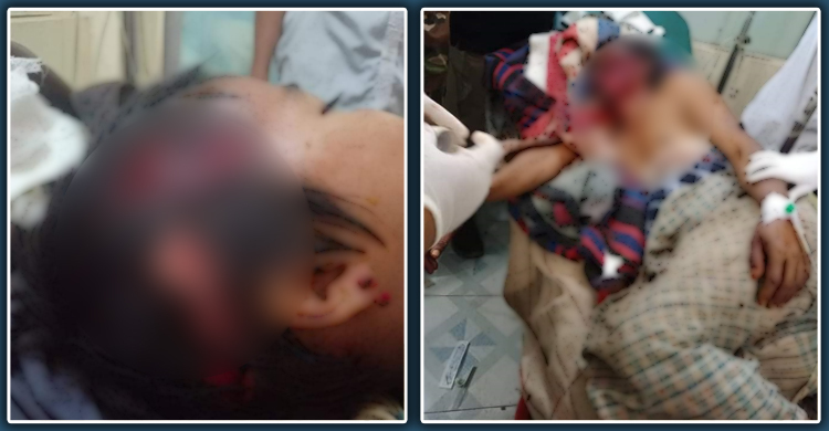 ভাল্লুকের আক্রমণে আহত গ্রামপ্রধান, হেলিকপ্টারে গেলেন হাসপাতালে