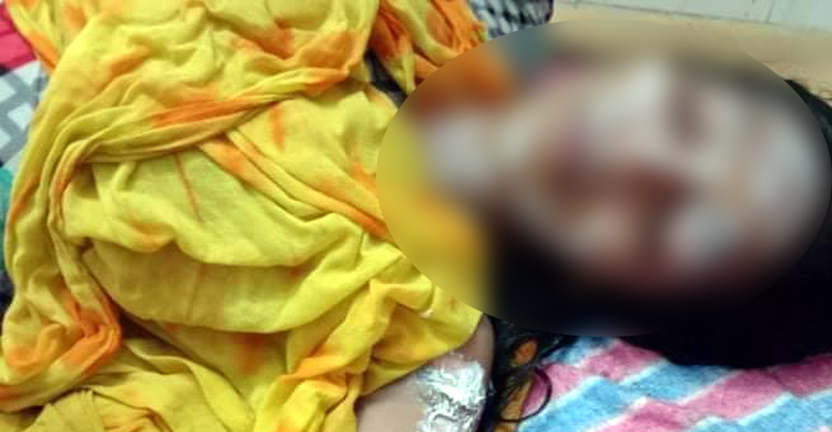 ছোট জা’র শরীরে গরম তরকারি ঢেলে দিলেন বড় জা