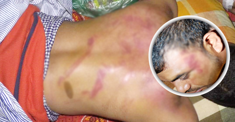 বাড়ি থেকে ডেকে নিয়ে প্রবাসীকে পেটালেন ছাত্রলীগ নেতা