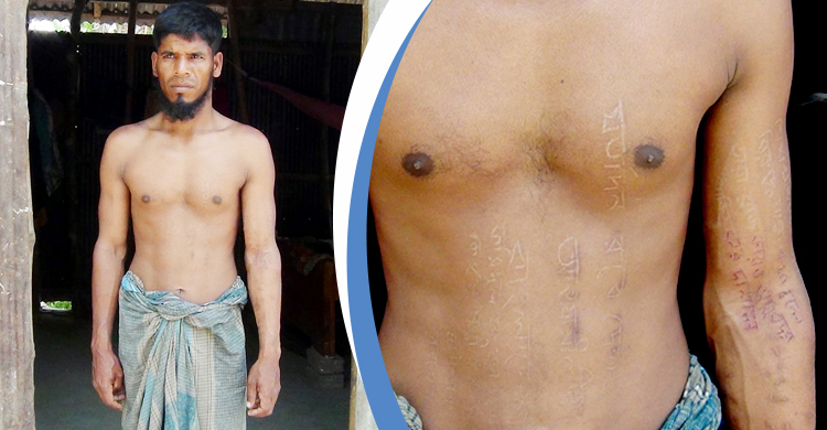 শরীর কেটে বঙ্গবন্ধু-প্রধানমন্ত্রী-আ.লীগের প্রতি ভালোবাসা প্রকাশ