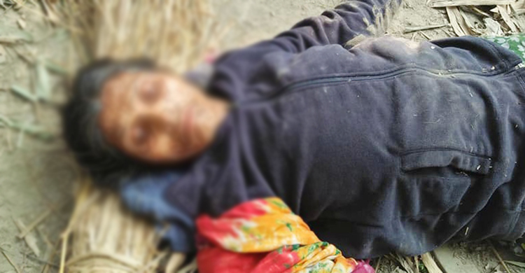 পিটিয়ে ফুফুর হাত-পা ভেঙে দিল ভাতিজা