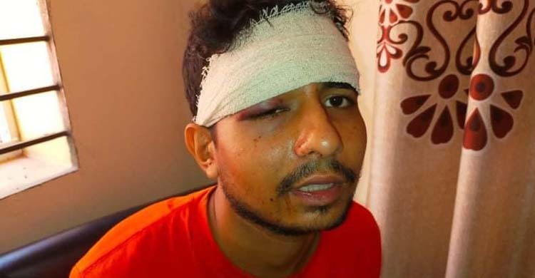 জামাইকে হাতুড়িপেটা করে পুলিশে দিলেন শ্বশুর