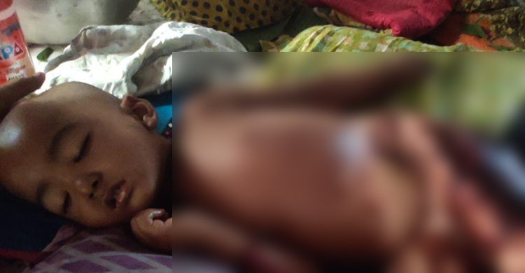 দগ্ধ শিশুর জন্য ওসির ভালোবাসা