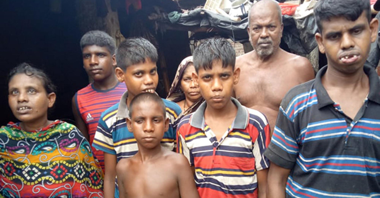 চিকিৎসকের ভুলে এক পরিবারে ৭ প্রতিবন্ধী