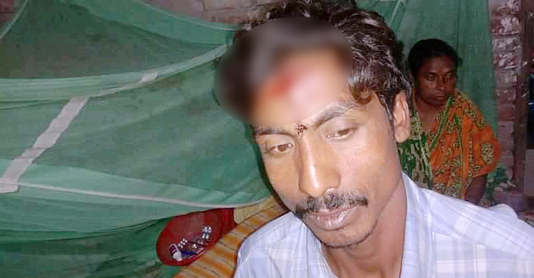 শার্শায় দুই মেম্বার প্রার্থীর সমর্থকদের সংঘর্ষে আহত ২২