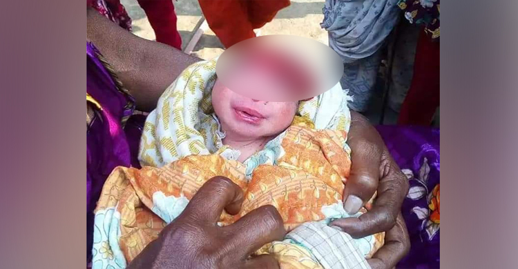 ঝিনাইদহে অদ্ভুত আকৃতির শিশুর জন্ম