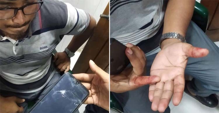জবিতে রোভারের সাবেক সভাপতির ওপর ছাত্রলীগের হামলা