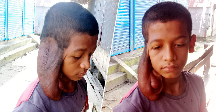দিন দিন কান বড় হয়ে যাচ্ছে শাহজালালের